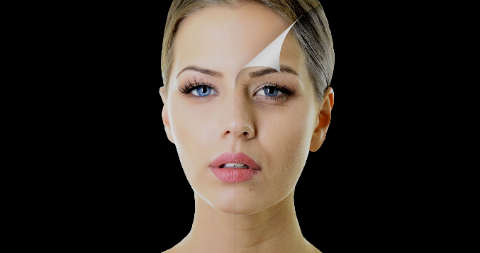 CHEMICAL PEEL