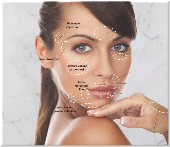 Dermal Fillers Advanced Facial Esthetics In Parma, OH Dermal Fillers Advanced Facial Esthetics In Parma, OH