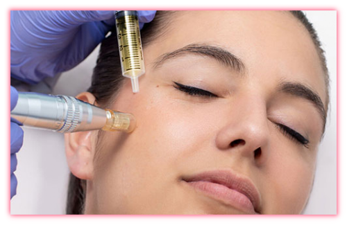 MICRONEEDLING WITH PRF DR.B'SPA | PARMA, OHIO MICRONEEDLING WITH PRF DR.B'SPA | PARMA, OHIO