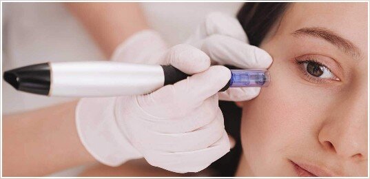RF MICRONEEDLING DR.B'SPA | PARMA, OHIO RF MICRONEEDLING DR.B'SPA | PARMA, OHIO